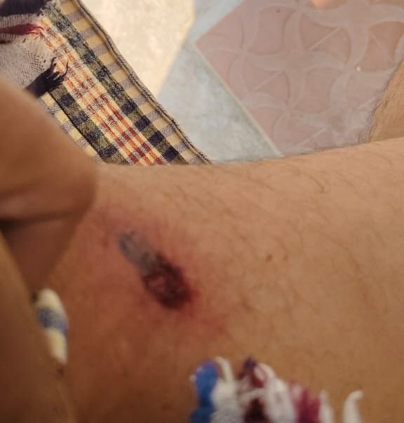 गया शहर से दो बड़ी खबर: वार्ड पार्षद पर चली गोली, बाल बाल बचे, वहीं जमीन विवाद में गोली लगने से एक की हालत गंभीर 1 image editor output image884562829 1747646634114147285124138368070 गया शहर से दो बड़ी खबर: वार्ड पार्षद पर चली गोली, बाल बाल बचे, वहीं जमीन विवाद में गोली लगने से एक की हालत गंभीर