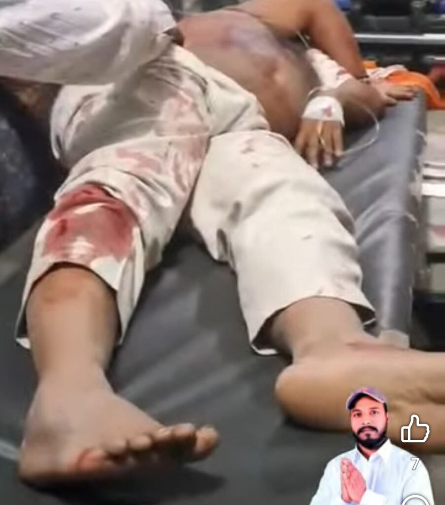 कांग्रेस नेता व पत्रकार नंदू चंद्रवंशी सड़क दुर्घटना में गंभीर रूप से घायल, हालत नाजुक, पटना में भर्ती 2 image editor output image 575019681 17610367232011326599200102739936 कांग्रेस नेता व पत्रकार नंदू चंद्रवंशी सड़क दुर्घटना में गंभीर रूप से घायल, हालत नाजुक, पटना में भर्ती