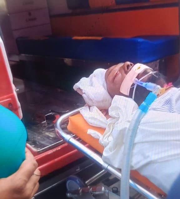 कांग्रेस नेता व पत्रकार नंदू चंद्रवंशी सड़क दुर्घटना में गंभीर रूप से घायल, हालत नाजुक, पटना में भर्ती 1 image editor output image 699277250 17610373967413694827288845113116 कांग्रेस नेता व पत्रकार नंदू चंद्रवंशी सड़क दुर्घटना में गंभीर रूप से घायल, हालत नाजुक, पटना में भर्ती