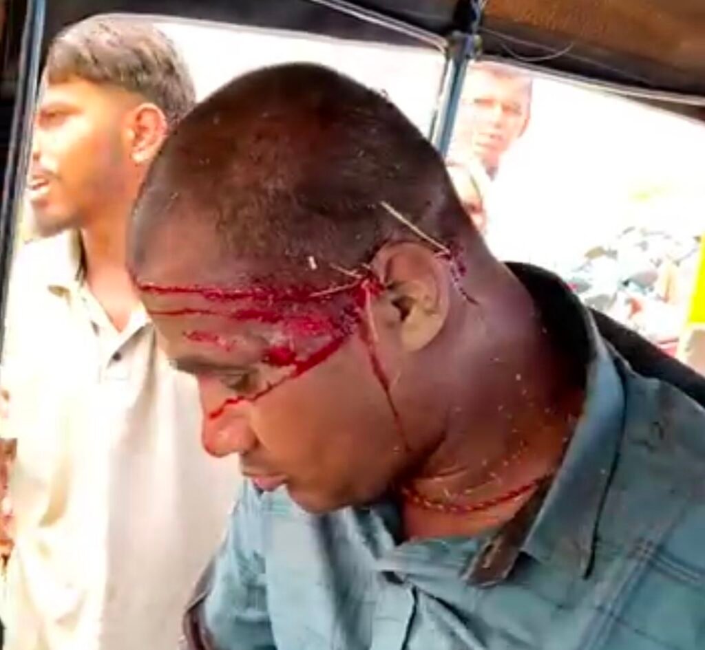 image editor output image 1501281354 17774488570827926471658065890220 ब्रेकिंग न्यूज़: अगरैली बायपास के पास बोलेरो ने दिव्यांग के वाहन में मारी टक्कर, दिव्यांग व्यक्ति की हालत गंभीर, पुलिस ने भेजा अस्पताल